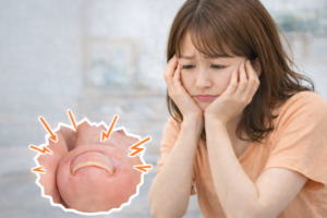 巻き爪に悩む女性