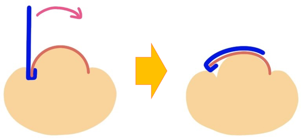 ペディグラスの巻き爪補正のイラスト(補正器具を爪先に引っ掛けて補正しているイラスト)