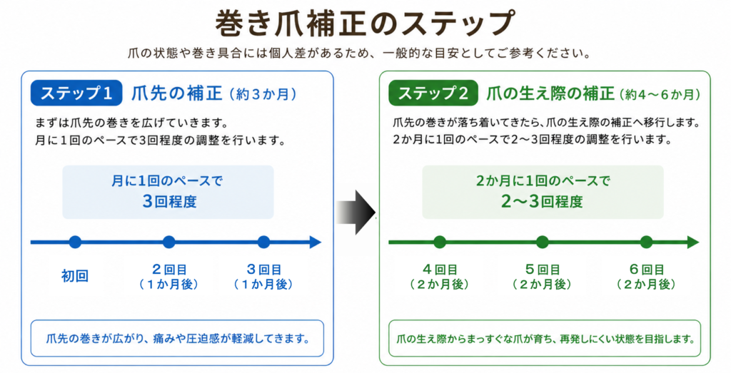巻き爪補正のステップ